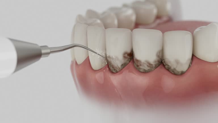 Trusted Root Canal Treatment service in Man, WV - Dentist Open Now